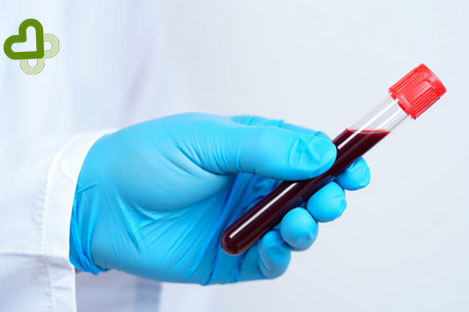 Колба с кровью в руке врача